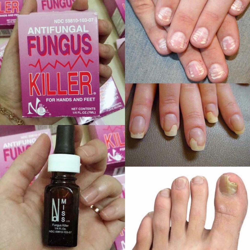 Antifungal Fungus Killer 1/4oz/7ml Full Size 1 Packs Made in USA