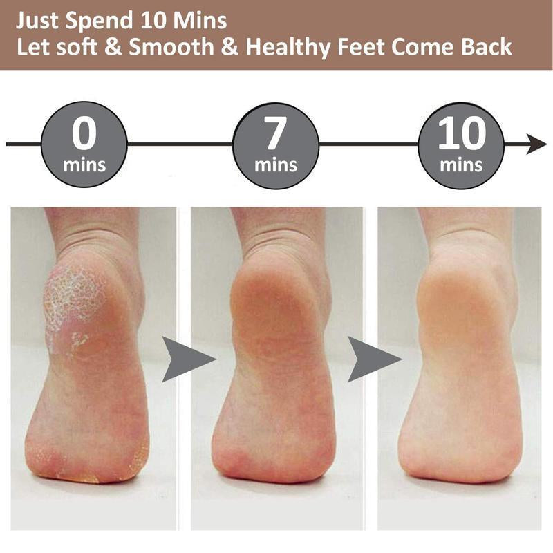 Tiktokshopbacktoschool Rechargeable Electric Foot Dead Skin Remover, Cordless Pedicure Machine, Foot Grinder, Portable Foot File Cleaning Tool for Home and Travel, Winter Gift, Valentine'S Day Gift, Electric Foot File, Foot Dead Skin Remover
